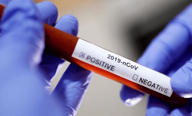 కేంద్ర మంత్రి క్రిషన్ పాల్ గుర్జార్‌కు కరోనా పాజిటివ్