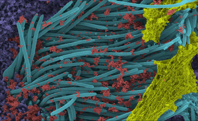 ఇదే కరోనా వైరస్ నిజమైన ఆకృతి