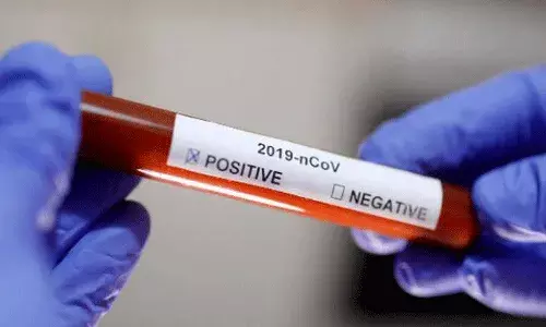 విజయనగరం జిల్లాలో 20మంది విద్యార్ధులకు కరోనా పాజిటివ్