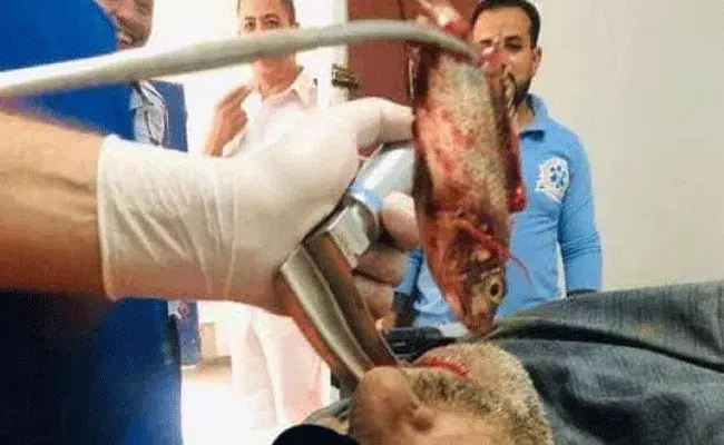 గేలానికి చిక్కిన చేప జాలరి గొంతులో..