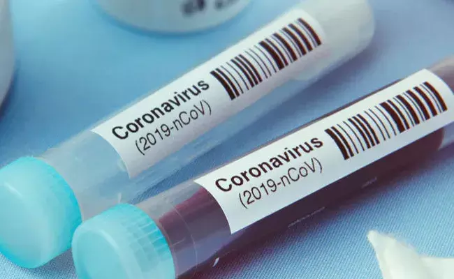 Telangana Corona Cases  : తెలంగాణలో  కొత్తగా 2,982 కరోనా కేసులు..! Telangana Corona Cases  : తెలంగాణలో  కొత్తగా 2,982 కరోనా కేసులు..!