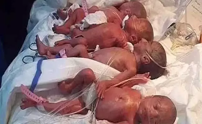 మాలి దేశంలో ఒకే కాన్పులో 9మంది జననం