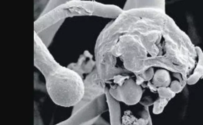 Black Fungus: ఆందోళన కలిగిస్తోన్న బ్లాక్ ఫంగస్