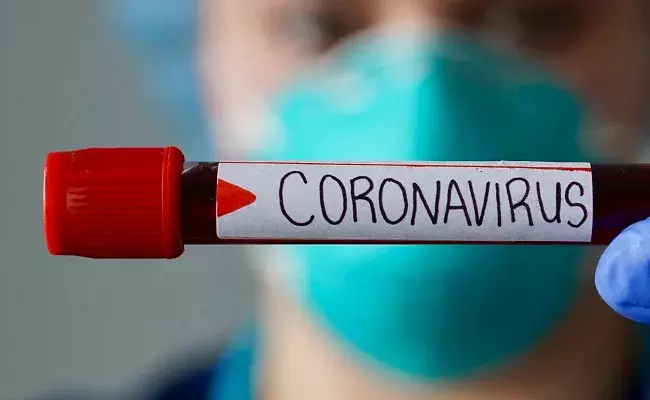 Ap Corona cases  : ఏపీలో కొత్తగా 20,937 కేసులు.. 104 మంది మృతి..! Ap Corona cases  : ఏపీలో కొత్తగా 20,937 కేసులు.. 104 మంది మృతి..!