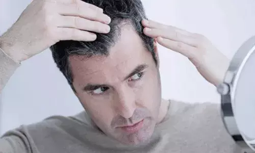 ఆయుర్వేదిక్ హోం రెమిడీ.. తెల్ల జుట్టు నల్లగా..