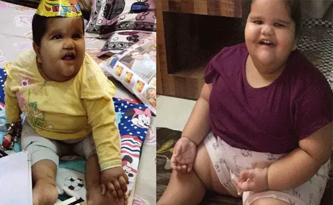 Bariatric Surgery : వయసు 2 ఏళ్లు.. బరువు 45 కేజీలు.. బేరియాట్రిక్ సర్జరీతో.. Bariatric Surgery : వయసు 2 ఏళ్లు.. బరువు 45 కేజీలు.. బేరియాట్రిక్ సర్జరీతో..