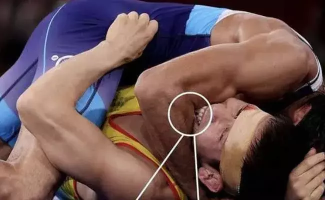 ఓడిపోతున్నానని చేయి కొరికాడు... ఇదేం  పద్ధతి?