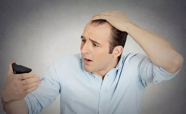 Baldness Solution (tv5news.in)