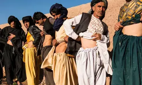 Afghanistan : ఆకలి తీర్చుకోవడం కోసం  కిడ్నీలు అమ్ముకుంటున్న ఆఫ్ఘనీలు..!