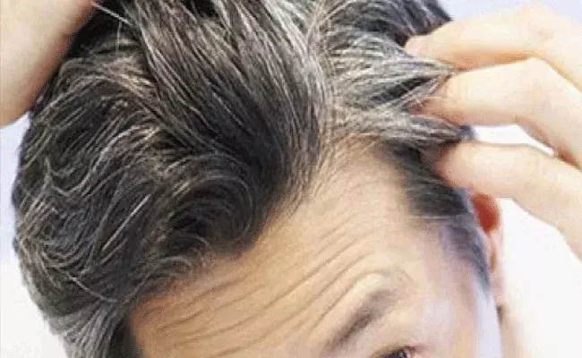 Grey Hair Control: తెల్లజుట్టు నివారణకు.. ఆహారంలో 6 విటమిన్లు.. Grey Hair Control: తెల్లజుట్టు నివారణకు.. ఆహారంలో 6 విటమిన్లు..