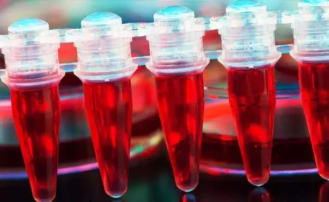 Microplastic In Blood : మనిషి రక్తంలో ప్లాస్టిక్‌ అవశేషాలు.. !