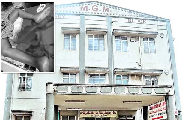 MGM Hospital : వరంగల్ ఎంజీఎం హాస్పిటల్లో దారుణం.. రోగి కాలు, వేళ్లు కొరికిన ఎలుకలు MGM Hospital : వరంగల్ ఎంజీఎం హాస్పిటల్లో దారుణం.. రోగి కాలు, వేళ్లు కొరికిన ఎలుకలు