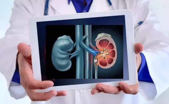 Kidney Stones: ఎండాకాలంలో కిడ్నీలో రాళ్లు ఎందుకు పెరుగుతాయి? డాక్టర్స్ ఏమంటున్నారు.. Kidney Stones: ఎండాకాలంలో కిడ్నీలో రాళ్లు ఎందుకు పెరుగుతాయి? డాక్టర్స్ ఏమంటున్నారు..