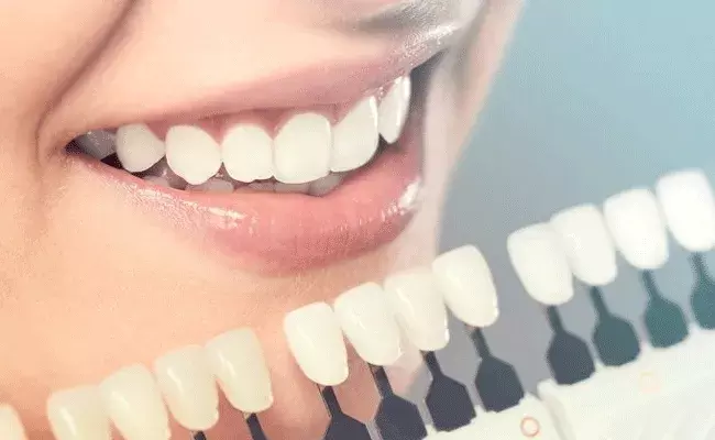 White Smile: మీ చిరునవ్వు అందంగా.. మీ పళ్లు తెల్లగా ఉండాలంటే.. ఇలా చెయ్యాలి..