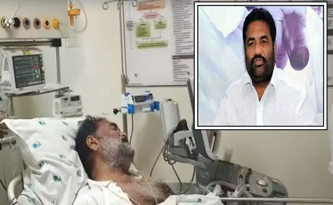 Kotamreddy Sridhar Reddy: ఎమ్మెల్యే కోటంరెడ్డి శ్రీధర్రెడ్డికి గుండెపోటు.. Kotamreddy Sridhar Reddy: ఎమ్మెల్యే కోటంరెడ్డి శ్రీధర్రెడ్డికి గుండెపోటు..