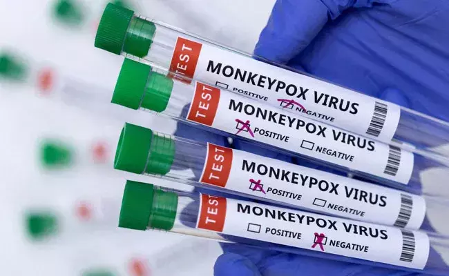 Monkeypox: ప్రజలను భయపెడుతున్న కొత్త వైరస్ మంకీపాక్స్.. ఈ వ్యాధిని గుర్తించేందుకు.. Monkeypox: ప్రజలను భయపెడుతున్న కొత్త వైరస్ మంకీపాక్స్.. ఈ వ్యాధిని గుర్తించేందుకు..