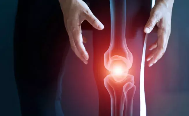 Bone Density: ఎముకలు దృఢంగా ఉండాలంటే.. ఏ ఏ ఆహార పదార్థాలు..