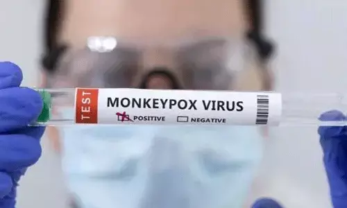 Monkeypox In India: కేరళలో మంకీపాక్స్ కేసు.. ఆ అయిదు జిల్లాలు అలర్ట్..
