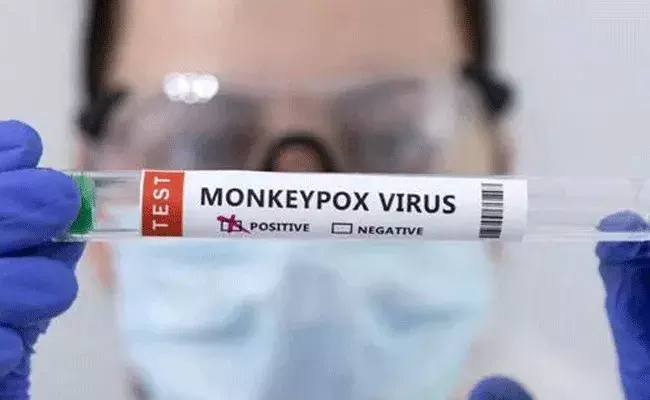 Monkeypox In India: కేరళలో మంకీపాక్స్ కేసు.. ఆ అయిదు జిల్లాలు అలర్ట్.. Monkeypox In India: కేరళలో మంకీపాక్స్ కేసు.. ఆ అయిదు జిల్లాలు అలర్ట్..