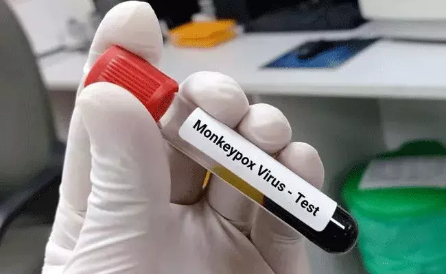 Monkeypox In India: కేరళలో మూడో మంకీఫాక్స్ కేసు నమోదు.. Monkeypox In India: కేరళలో మూడో మంకీఫాక్స్ కేసు నమోదు..