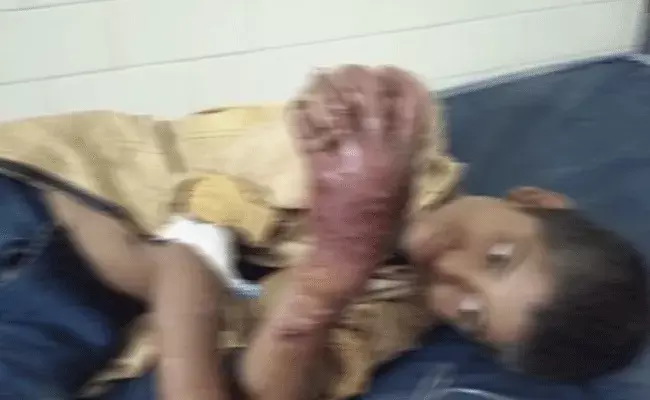 Mancherial : కసాయి తండ్రి.. విలవిలలాడిన బాలుడు.. Mancherial : కసాయి తండ్రి.. విలవిలలాడిన బాలుడు..