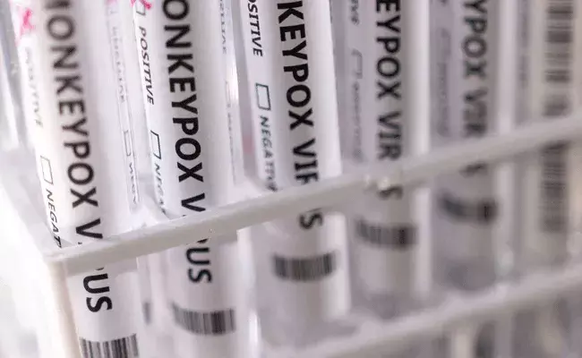 Monkeypox: మంకీపాక్స్ కలకలం.. ఆ దేశంలో మొదటి కేసు..