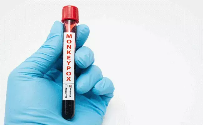 Monkeypox In India: భారత్లో 8కి చేరిన మంకీపాక్స్ కేసుల సంఖ్య.. Monkeypox In India: భారత్లో 8కి చేరిన మంకీపాక్స్ కేసుల సంఖ్య..