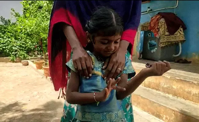 Nellore: అంగన్వాడీ టీచర్ కర్కశం.. ఆరేళ్ల చిన్నారి ఒంటిపై వాతలు.. Nellore: అంగన్వాడీ టీచర్ కర్కశం.. ఆరేళ్ల చిన్నారి ఒంటిపై వాతలు..