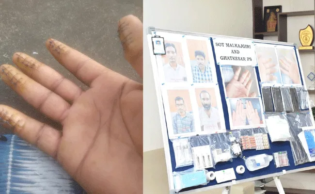 Finger Print Scam : ఆపరేషన్తో ఫింగర్ ప్రింట్లు మార్చుకొని స్మగ్లింగ్.. Finger Print Scam : ఆపరేషన్తో ఫింగర్ ప్రింట్లు మార్చుకొని స్మగ్లింగ్..