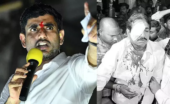 Nara Lokesh : ఈ నెత్తుటి రాజకీయాలు ఇంకెన్నాళ్లు చేస్తారు : నాారా లోకేష్ Nara Lokesh : ఈ నెత్తుటి రాజకీయాలు ఇంకెన్నాళ్లు చేస్తారు : నాారా లోకేష్