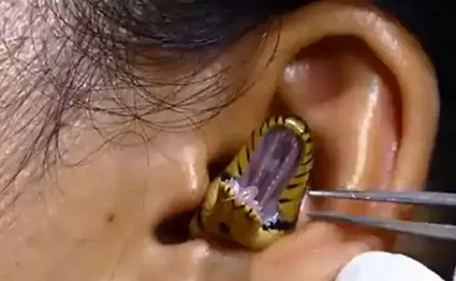 Viral Video: చెవిలో దూరిన పాము.. ఈ వీడియో చూడాలంటే చాలా ధైర్యం కావాలి..