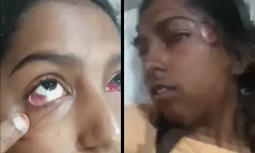 Gymkhana Ground : జింఖానా గ్రౌండ్ తొక్కిసలాటలో యువతికి తీవ్ర గాయాలు.. చికిత్సకు నిరాకరించిన కార్పొరేట్ ఆస్పత్రి.. Gymkhana Ground : జింఖానా గ్రౌండ్ తొక్కిసలాటలో యువతికి తీవ్ర గాయాలు.. చికిత్సకు నిరాకరించిన కార్పొరేట్ ఆస్పత్రి..