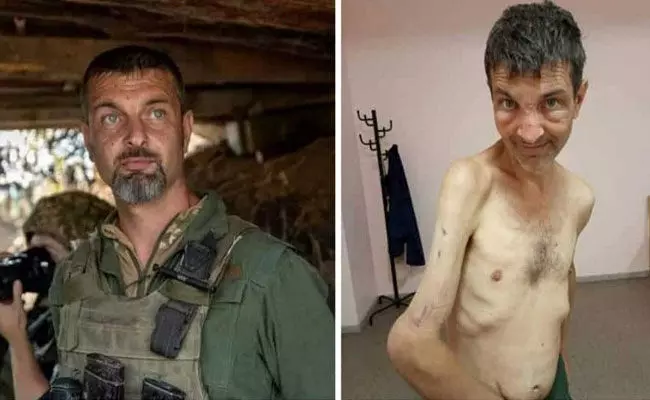 Russia- Ukrain War: రష్యా చెరలో మూడు నెలలు.. ఉక్రెయిన్ సైనికుడి పరిస్థితి విషమం.. Russia- Ukrain War: రష్యా చెరలో మూడు నెలలు.. ఉక్రెయిన్ సైనికుడి పరిస్థితి విషమం..