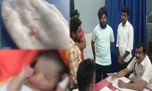 Macherla : వైద్యుల నిర్లక్ష్యం.. బొడ్డు పేగును కట్ చేయబోయి.. Macherla : వైద్యుల నిర్లక్ష్యం.. బొడ్డు పేగును కట్ చేయబోయి..