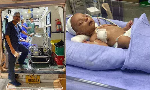 Hyderabad Rainbow Hospital : రెయిన్బో చిల్డ్రన్స్ హాస్పిటల్స్ సరికొత్త రికార్డ్.. దేశంలోనే మొదటిసారి.. Hyderabad Rainbow Hospital : రెయిన్బో చిల్డ్రన్స్ హాస్పిటల్స్ సరికొత్త రికార్డ్.. దేశంలోనే మొదటిసారి..