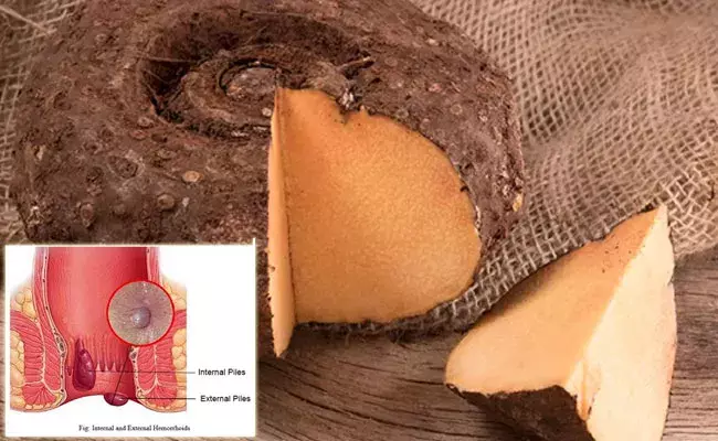 Jimikand benefits: కందలో కావలసినన్ని పోషకాలు.. పైల్స్ని తగ్గించడంలో.. Jimikand benefits: కందలో కావలసినన్ని పోషకాలు.. పైల్స్ని తగ్గించడంలో..