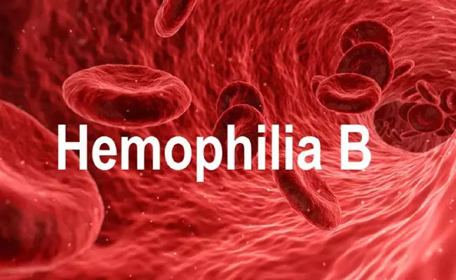 Hemophilia B : హిమోఫిలియో బి సమస్యకు మెడిసిన్.. ధర తెలిస్తే గుండె ఢమాల్.. Hemophilia B : హిమోఫిలియో బి సమస్యకు మెడిసిన్.. ధర తెలిస్తే గుండె ఢమాల్..