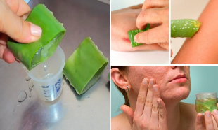 Beauty Tips: కలబందతో అందం; ఈజీగా ఇంట్లోనే ఫేషియల్ జెల్‌