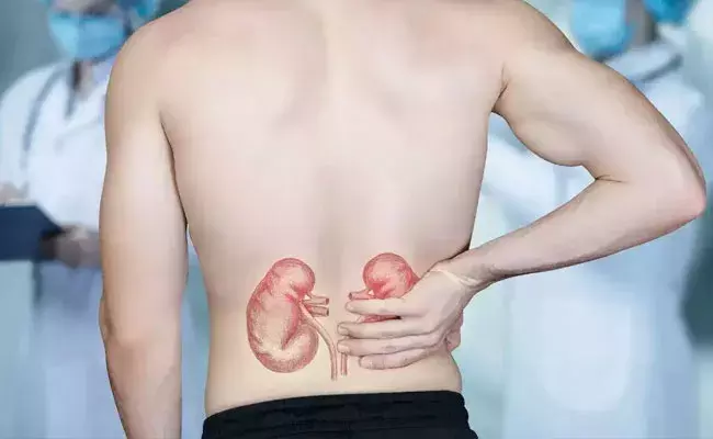 Healthy Kidneys: శరీరంలో ముఖ్య అవయవం కిడ్నీ.. ఆరోగ్యంగా ఉండాలంటే.. Healthy Kidneys: శరీరంలో ముఖ్య అవయవం కిడ్నీ.. ఆరోగ్యంగా ఉండాలంటే..