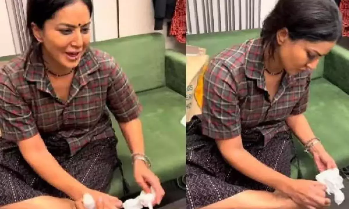 Sunny Leone: షూటింగ్ లో గాయపడిన సన్నీ Sunny Leone: షూటింగ్ లో గాయపడిన సన్నీ
