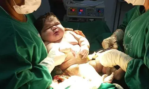 Brazil: బ్రెజిల్‌లో భీముడు పుట్టాడు..