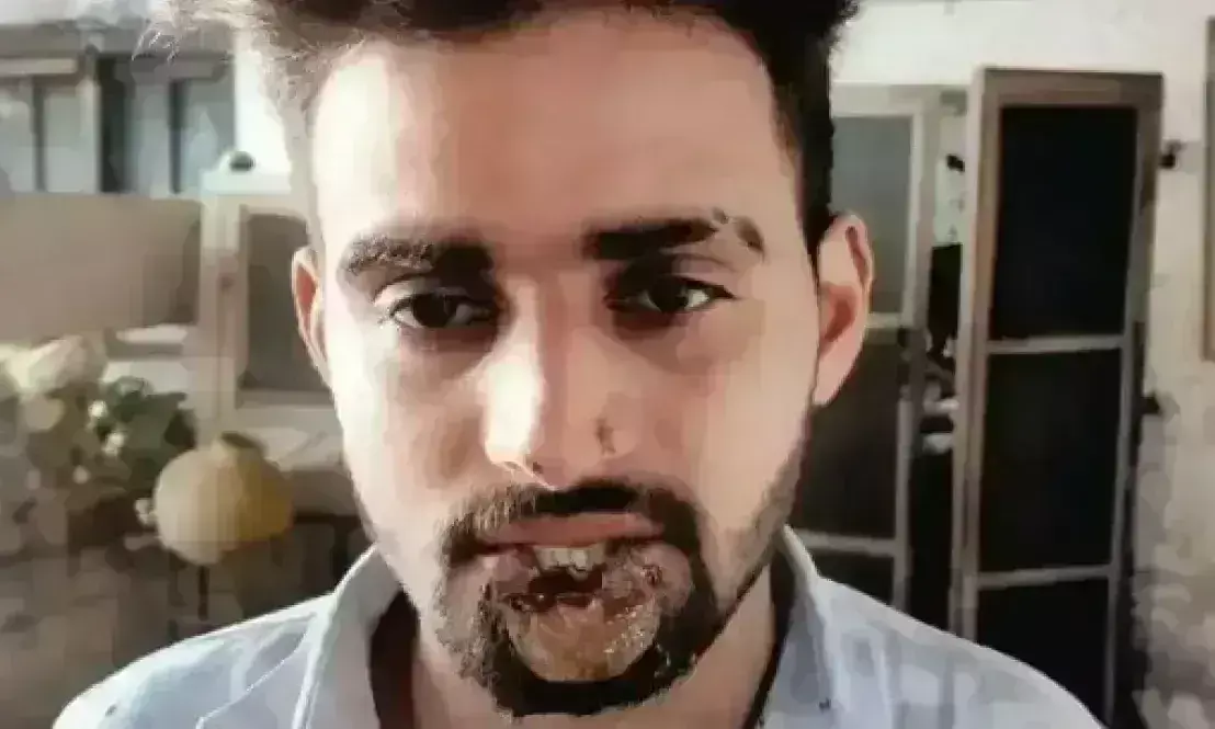 UP: బలవంతంగా ముద్దుపెట్టబోతే... కొరికిపారేసింది...