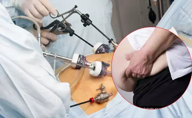 Bariatric Surgery in Osmania: ఉస్మానియాలో బేరియాట్రిక్ సర్జరీ.. 240 కేజీల బరువున్న యువకుడికి..