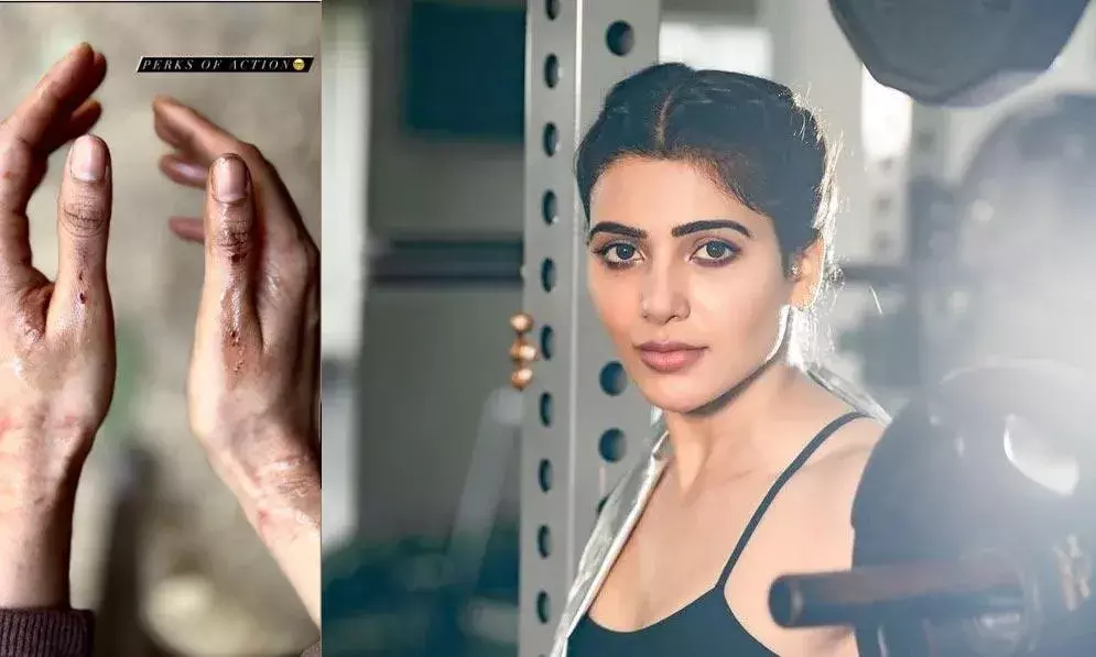 Tollywood: సమంత చేతులకు గాయాలు Tollywood: సమంత చేతులకు గాయాలు