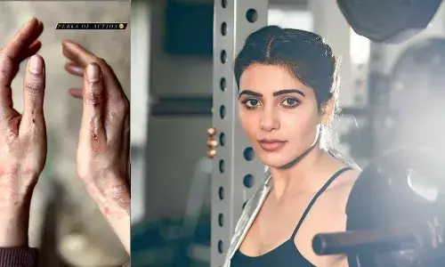 Tollywood: సమంత చేతులకు గాయాలు Tollywood: సమంత చేతులకు గాయాలు