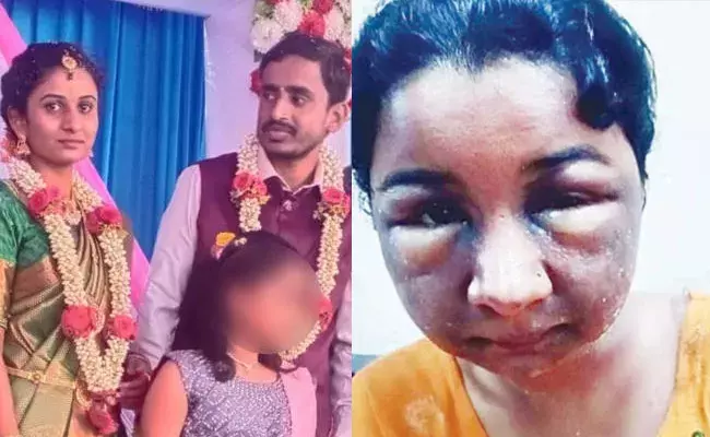 Karnataka: బ్రైడల్ మేకప్ బెడిసి కొట్టింది.. పెళ్లొద్దన్న వరుడు Karnataka: బ్రైడల్ మేకప్ బెడిసి కొట్టింది.. పెళ్లొద్దన్న వరుడు