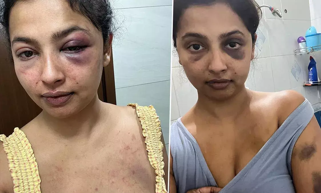 Actress Attack: బాయ్ ఫ్రెండ్ చేతిలో చావు దెబ్బలు Actress Attack: బాయ్ ఫ్రెండ్ చేతిలో చావు దెబ్బలు