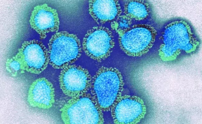 H3N2 Virus: భయపెడుతున్న కొత్త వైరస్ H3N2 ఇన్ఫ్లుఎంజా.. లక్షణాలు, చికిత్స