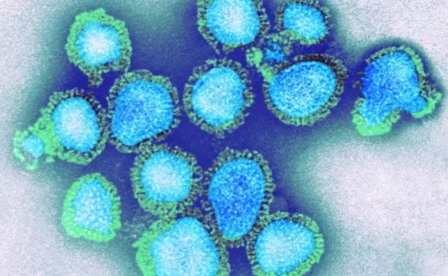 H3N2 Virus: భయపెడుతున్న కొత్త వైరస్ H3N2 ఇన్ఫ్లుఎంజా.. లక్షణాలు, చికిత్స