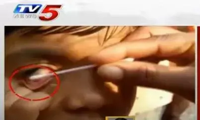 అమ్మో పాప కంటి నుంచి ప్లాస్టిక్, ఇనుము అమ్మో పాప కంటి నుంచి ప్లాస్టిక్, ఇనుము